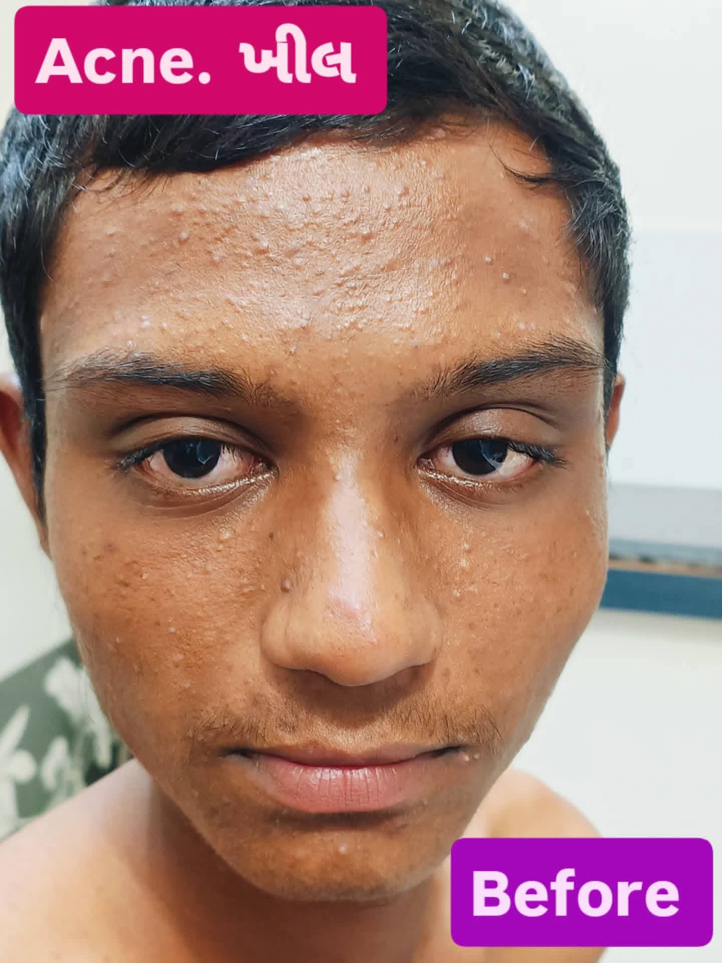 Before treatment