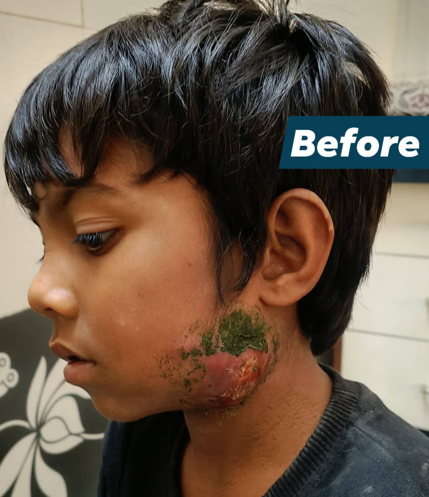 Before treatment
