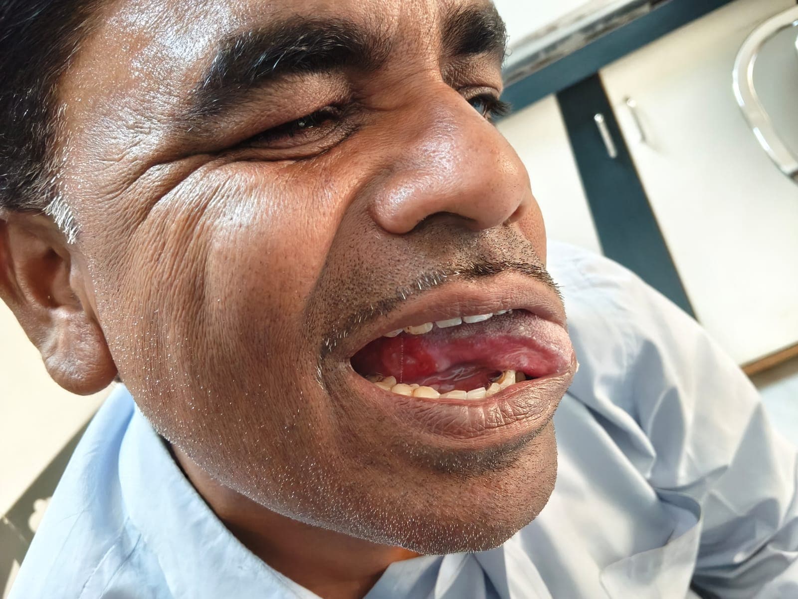 After treatment