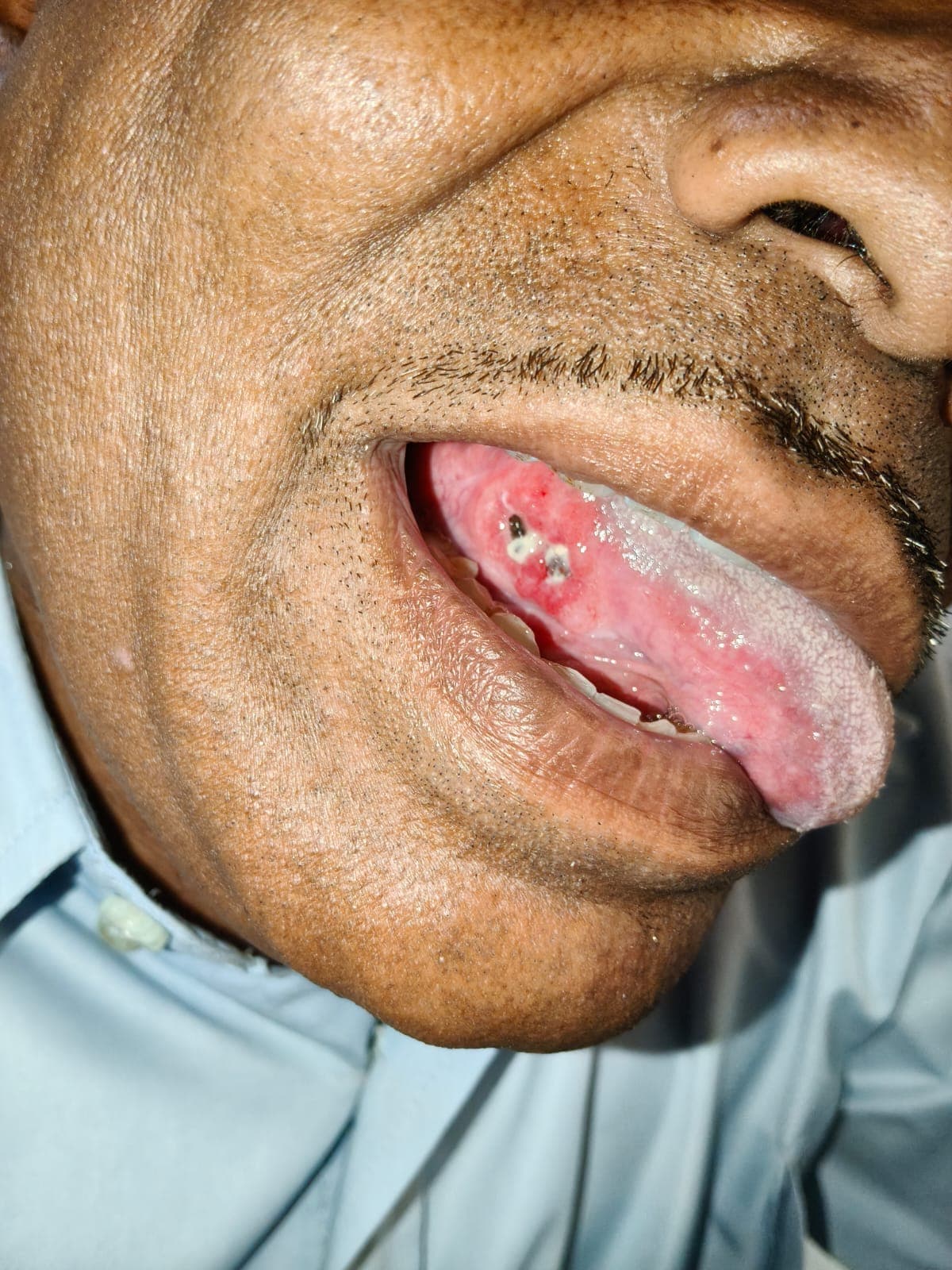 Before treatment