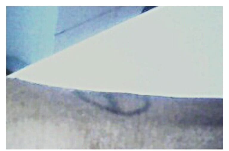 After treatment
