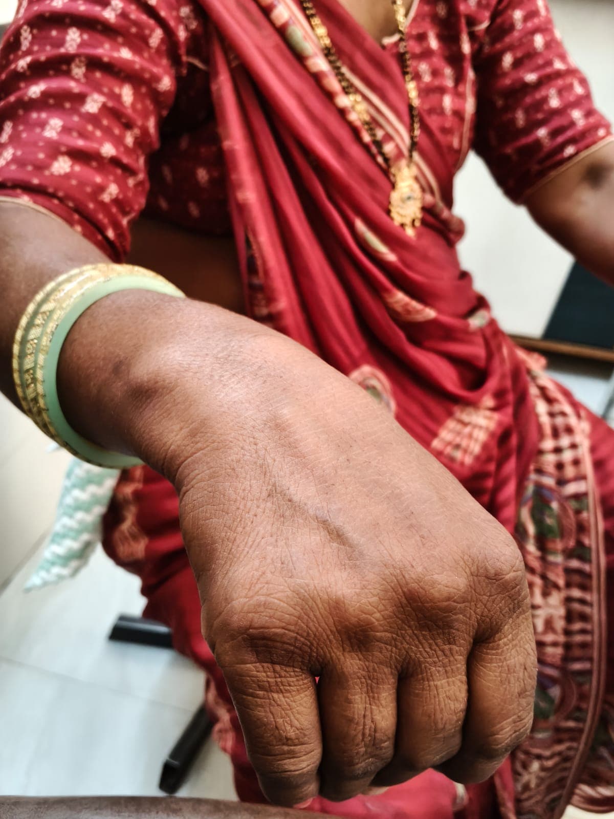 After treatment