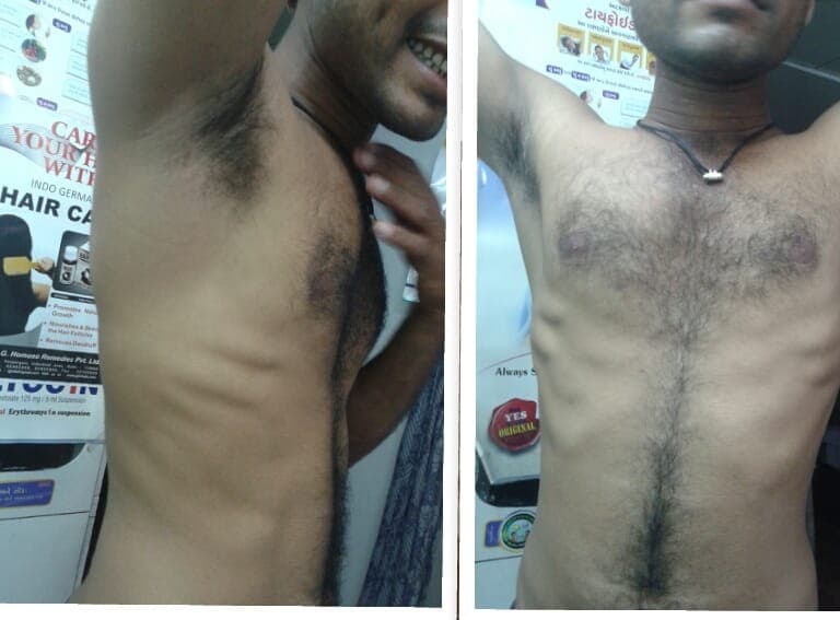 After treatment