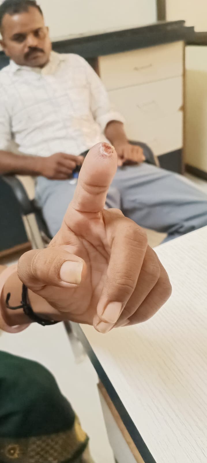 After treatment