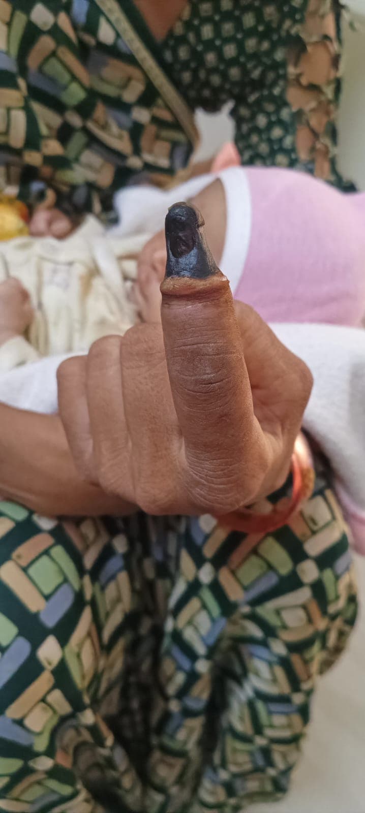 Before treatment