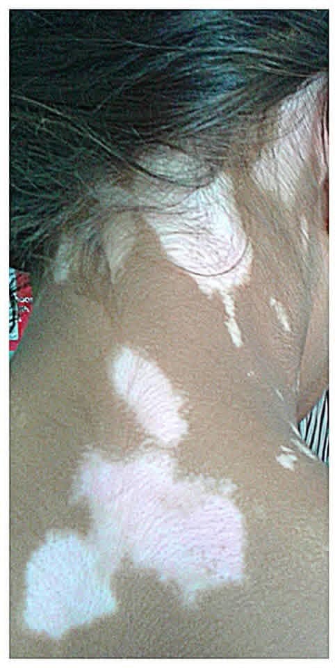 Before treatment